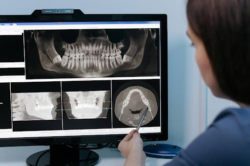Dentist reviewing digital dental X-ray images on computer screen